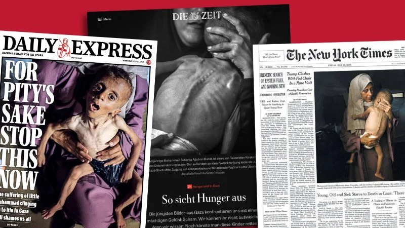 Titelseiten mit dem Foto eines mangelernährten Kindes in Gaza