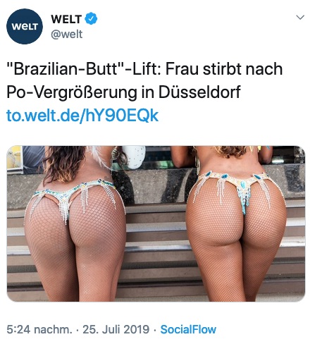 'Brazilian-Butt'-Lift: Frau stirbt nach Po-Vergrößerung in Düsseldorf 